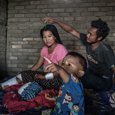 စစ်တပ်ဖြတ်ခဲ့တဲ့ ခြေတစ်ဖက်နဲ့ ကြံ့ကြံ့ခံအသက်