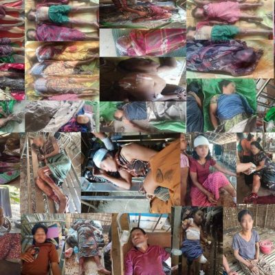 ပုဏ္ဏားကျွန်းမြို့၊ ယိုးငူဗုံးကြဲခံရမှု သေဆုံးသူ ၂၀ ဦးအထိရှိလာ