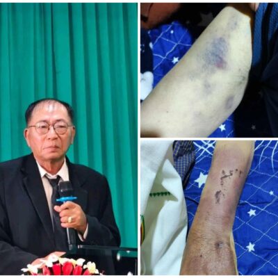 သတင်းပေးဟုဆိုကာ PDF Zoland ဖမ်းဆီးခဲ့သည့် တည်းခိုခန်းပိုင်ရှင် ရက်ပိုင်းအတွင်း သေဆုံး၊ အလောင်း၌ ဒဏ်ရာများတွေ့ရှိ