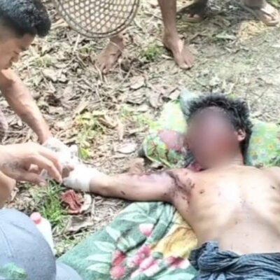 မောင်တောတွင် အရပ်သားတစ်ဦး မြေမြှုပ်မိုင်း နင်းမိပြီး ခြေထောက်တစ်ဖက်ပြတ်တောက်ဒဏ်ရာရ