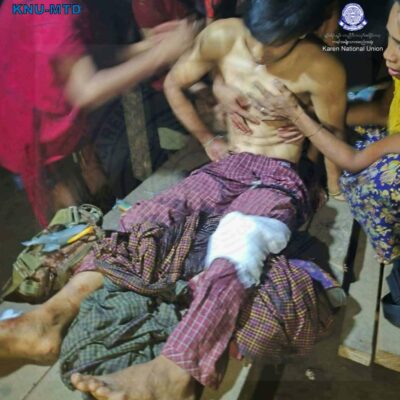 တနင်္သာရီတွင် စစ်တပ်ပစ်သည့် လက်နက်ကြီးထိမှန်ကာ ရွာသားတစ်ဦး သေဆုံး၊ ၅နှစ်အရွယ် ကလေးငယ် ခြေတစ်ဖက်ပြတ်